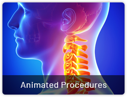 Animated Procedures